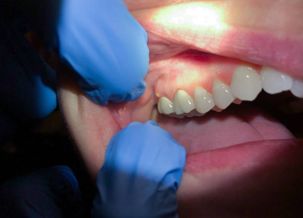  Laughlin Af, TX Emergency Dentist Pros