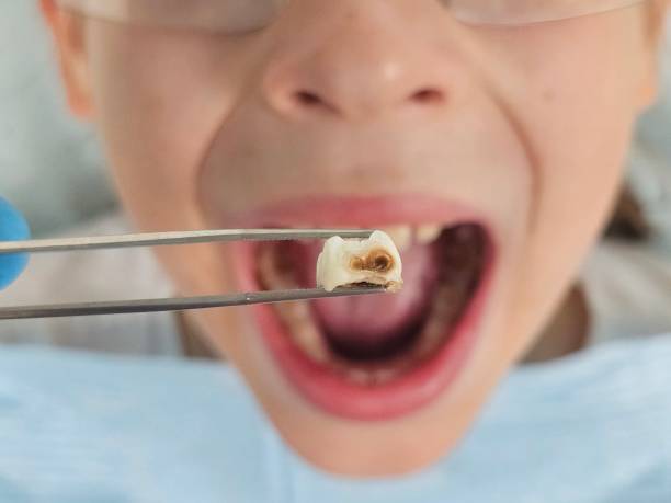 Best Urgent Dental Care for Toothaches in Laughlin Af, TX