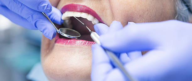 Best Knocked-Out Tooth (Avulsed Tooth) Treatment in Laughlin Af, TX